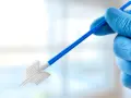 Ręka w niebieskiej rękawiczce trzyma niebiesko-biały przyrząd do pobierania wymazów, kluczowy w diagnostyce cytologia płynna.