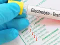 Ręka w niebieskiej rękawiczce trzyma probówkę z oznaczeniem "Electrolyte - Test" nad formularzem z badaniami, w tym jonogramem.