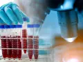 Rękawiczka laboratoryjna trzyma probówkę z krwią na tle mikroskopu.