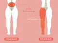 Illustration comparant le lumbago et la sciatique. La sciatique, combien de temps dure-t-elle ? Le nerf sciatique est montré irradiant dans la jambe.
