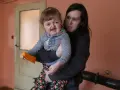 Matka trzyma dziecko z zespołem Aperta. Długość życia zależy od wielu czynników, ale miłość i wsparcie są kluczowe.
