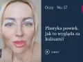 Kobieta z plastrem na powiekach górnych, przygotowująca się do zabiegu korekty powiek.