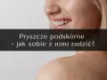 Uśmiechnięta twarz z piegami i pryszczami. Na ramionach widoczne są kolejne zmiany skórne. Tekst: "Pryszcze podskórne - jak sobie z nimi radzić?".