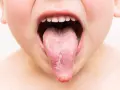 Wędrujące bóle stawów: Borelioza czy reumatyzm? Rozwiąż zagadkę