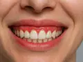 Uśmiech z widocznymi dziąsłami, które nadają mu charakterystyczny "gummy smile".