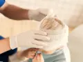 Manos enguantadas vendan la cabeza de un niño, curando sus heridas.