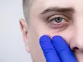 Dłoń w niebieskiej rękawiczce dotyka skóry pod okiem, sugerując poszukiwanie sposobu, jak pozbyć się cieni pod oczami na zawsze.