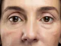 Nahaufnahme eines Gesichts, das schlaffe Haut unter den Augen zeigt, mit feinen Linien und Falten, die die Spuren der Zeit erzählen.