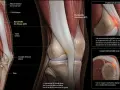 Anatomie du genou montrant le frottement de la bandelette ilio-tibiale sur le condyle fémoral, cause du syndrome de l'exercice essuie-glace.