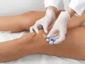Lekarz w białej rękawiczce podaje zastrzyk w kolano, by złagodzić uczucie blokady w kolanie.
