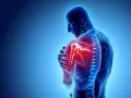 Anatomie d'un homme montrant une douleur vive à l'arrière de l'épaule, mise en évidence par une zone rouge intense.