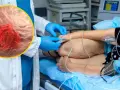 Lekarz w rękawiczkach przygotowuje pacjenta do zabiegu, ilustrując najnowsze metody leczenia raka jelita grubego. W powiększeniu widać komórki nowotworowe.