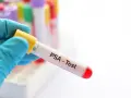 Rękawiczka trzyma probówkę z napisem "PSA - Test". To badanie psa, które pozwala ocenić jego stan zdrowia.