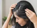 Kobieta dotyka swoich włosów, które wydają się przerzedzone. Widać delikatne baby hair przy skórze głowy.