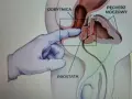 Rękawiczka wchodzi do odbytnicy, dotykając prostaty. To ilustracja badania, nie masaż grecki.