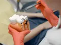 Model zęba pokazuje uszkodzenie miazgi, wyjaśniając, dlaczego leczenie kanałowe jest takie drogie.