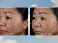 Before and after images show a woman's face with areas of damaged skin barrier highlighted. After 24 hours, the skin appears calmer and less irritated.