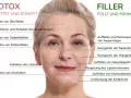 Gesicht einer Frau mit markierten Bereichen für Botox und Filler zur Behandlung von falten im gesicht, Stirnfalten, Krähenfüßen und Marionettenfalten.