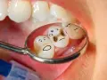 Zepsute zęby z narysowanymi buźkami w lusterku dentystycznym.