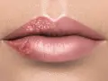 Usta z opryszczką. Czy z opryszczką można iść do dentysty? Pęcherzyki na wardze górnej i dolnej.