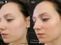Dr Irena Eris VitaCeric: Rozświetlenie i rewitalizacja. Czy warto?