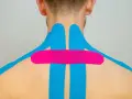 Nacken tapen bei Verspannungen: Blaues und pinkes Kinesio-Tape zur Linderung von Nackenschmerzen und Verspannungen.