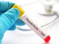 Ręka w niebieskiej rękawiczce trzyma probówkę z napisem "Procalcitonin - Test". To ważny pct.