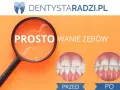 Prostowanie zębów domowymi sposobami: mity, ryzyko i alternatywy