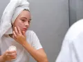 Mädchen mit Handtuch auf dem Kopf trägt Zinksalbe auf Pickel im Gesicht auf.