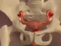 Anatomical model showing the female reproductive system within the pelvis. The uterus has undergone usunięcie macicy, with sutures visible at the cervical stump.