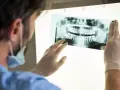 Jak często do dentysty? Pełny przewodnik: dzieci, dorośli, NFZ.