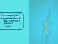Anatomia kolana z zaznaczonym więzadłem pobocznym piszczelowym (MCL). Grafika informuje o uszkodzeniach, objawach i leczeniu.