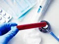 Rękawiczka z niebieskiej gumy trzyma probówkę z krwią. Obok leżą maseczka, tabletki, strzykawka i stetoskop. To może być badanie ast co to jest.