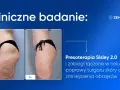 Przed i po zabiegu Presoterapia Sisley 2.0. Widoczna poprawa sylwetki dzięki mechanicznemu drenażowi limfatycznemu, redukcja obrzęków i cellulitu.