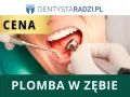 Ile kosztuje plomba światłoutwardzalna na nfz? Sprawdź, kto może skorzystać
