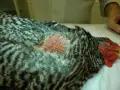 Gallina con gozzo infiammato, piume grigie e bianche, testa rossa.