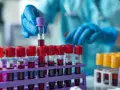 Laborant w niebieskich rękawiczkach przygotowuje próbki krwi do badań immunologicznych.