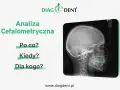 Analiza cefalometryczna: zdjęcie RTG czaszki z naniesionymi liniami i kątami. Pytania: Po co? Kiedy? Dla kogo?