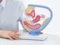 Model anatomiczny narządów rodnych kobiety. W tle osoba w jasnej koszuli, która może wyjaśniać procedurę biopsji endometrium.