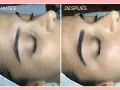 Comparativa de microblading cejas: antes y después. Las cejas lucen más definidas y pobladas tras el tratamiento.