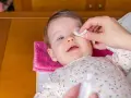 Delikatne przemywanie oka niemowlaka wacikiem nasączonym solą fizjologiczną.
