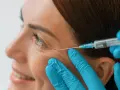 Botox Allergan czy Azzalure - które rozwiązanie naprawdę działa lepiej?