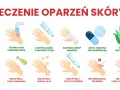 Co na oparzenie wrzątkiem domowe sposoby: chłodna woda, maść z antybiotykiem, zimny kompres, aloes. Unikaj masła, jajka, pasty do zębów, lodu.