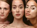 Drei Frauen mit unterschiedlichen Hauttypen: Sommersprossen, Akne und Vitiligo. Jede Haut verdient die passende mischhaut pflege.
