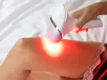 Dłoń trzyma depilator laserowy nad udem, emitując czerwone światło. Czy depilacja laserowa jest szkodliwa?