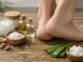 Pieds secs avec le talon craquelé, entourés d'ingrédients naturels pour un soin : aloe vera, sel, huiles et crème.