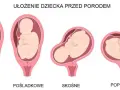 Kiedy dziecko obraca się główką w dół? Poznaj kluczowe informacje