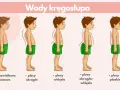 Ilustracja pokazuje wady kręgosłupa: plecy okrągłe, wklęsłe, okrągło-wklęsłe i płaskie, obok prawidłowej postawy.