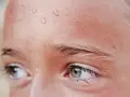 Gotas de sudor en la frente de una persona, un síntoma común de hiperhidrosis facial.