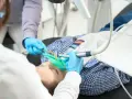 Ile trwa odbudowa zęba? Od minuty do miesięcy poznaj czas leczenia